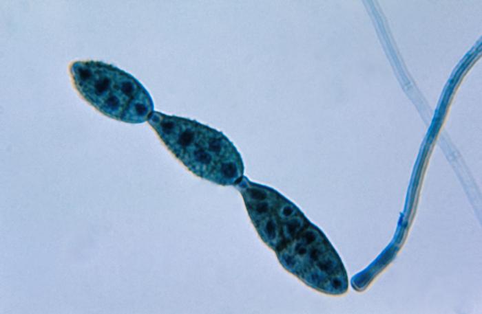Alternaria Mold