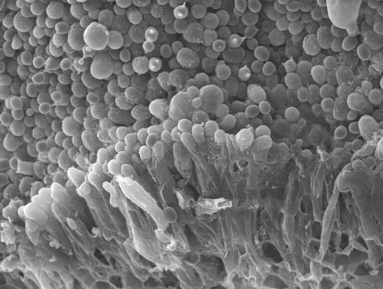Basidiospores